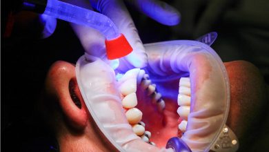 טיפול שורש אצל מומחה יכול להציל את השן ולמנוע כאבי שיניים