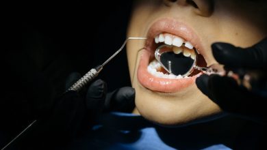 טיפול שיניים בהרדמה כללית. מהן האלטרנטיבות?